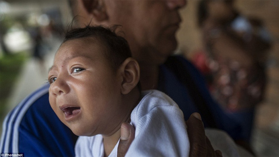 Đầu nhỏ - Hình ảnh minh họa